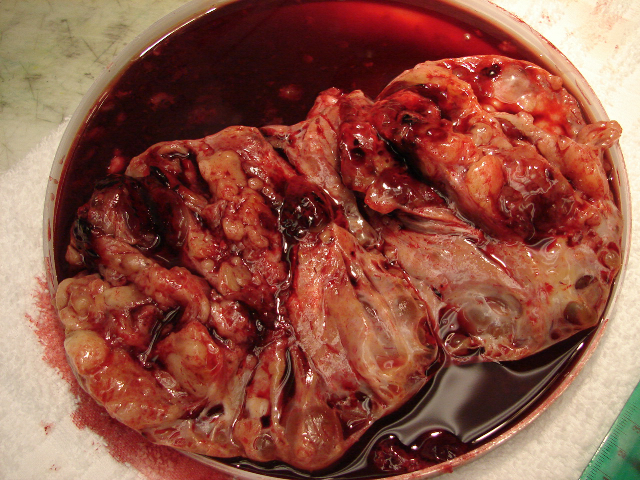 Pathology Image