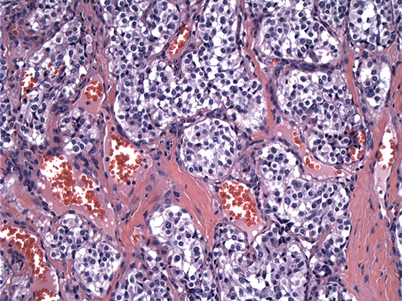 Pathology Image