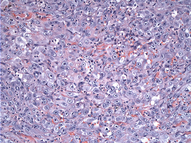 Pathology Image